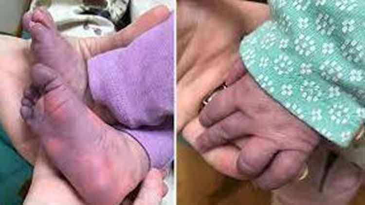 കോവിഡിനിടെ കുട്ടികളില് ‘മിസ്ക്’, കേരളത്തില് നാല് മരണം” മരണം തിരുവനന്തപുരം, കോഴിക്കോട് ജില്ലകളിൽ കോവിഡിനിടെ കുട്ടികളില് ‘മിസ്ക്’, കേരളത്തില് നാല് മരണം” മരണം തിരുവനന്തപുരം, കോഴിക്കോട് ജില്ലകളിൽ