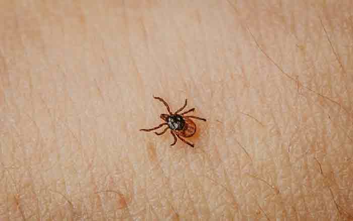 തിരുവനന്തപുരത്ത് വീണ്ടും ചെള്ളുപനി മരണം; പരശുവയ്ക്കൽ സ്വദേശിനി മരിച്ചു