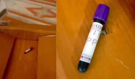 ആമസോൺ വഴി ഓർഡർ ചെയ്തത് കസേര; യുവതിക്ക് ലഭിച്ചത് രക്തമടങ്ങിയ ട്യൂബ്