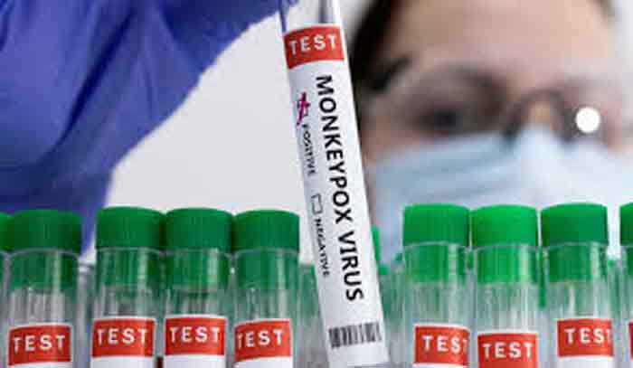 പുരുഷ സ്വവർഗാനുരാഗികൾ മങ്കിപോക്സ് വൈറസ് വാഹകരെന്ന് മുദ്രകുത്തൽ ; മങ്കിപോക്സ് ടെസ്റ്റ് നടത്താൻ സ്വവർഗാനുരാഗികൾ മടിക്കുന്നു